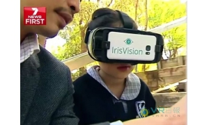 通過來自IrisVision的援助 黃斑變性女孩的視力將得