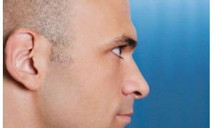 法國男子無臉近兩月 無臉是怎么一回事