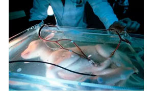 當人造子宮誕生 你愿意讓孩子從人造子宮孵化出