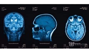 CrashCourse正式公布腦部保護(hù)VR課程內(nèi)容 分四部分供