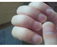 螞蟻莊園指甲周圍長倒刺 莊園小課堂11.18日答案