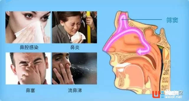 再也不怕沙塵暴，這只洗鼻器讓你隨時通暢呼吸